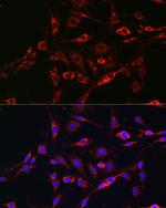 RAB5 Antibody in Immunocytochemistry (ICC/IF)