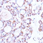 ISG15 Polyclonal Antibody