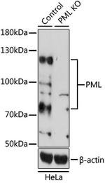 PML Antibody in Western Blot (WB)