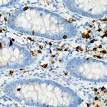 CD8 Antibody in Immunohistochemistry (Paraffin) (IHC (P))