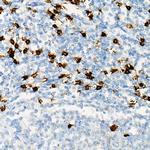 CD8 Antibody in Immunohistochemistry (Paraffin) (IHC (P))