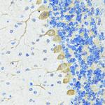 Nestin Antibody in Immunohistochemistry (Paraffin) (IHC (P))