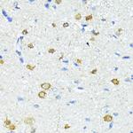 Nestin Antibody in Immunohistochemistry (Paraffin) (IHC (P))