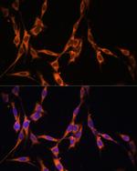 K-Ras Polyclonal Antibody