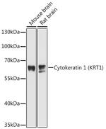 Cytokeratin 1 Polyclonal Antibody