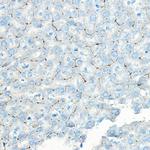 LNPEP Antibody in Immunohistochemistry (Paraffin) (IHC (P))