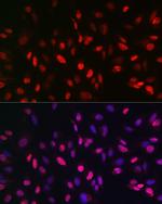 JMJD1A Antibody in Immunocytochemistry (ICC/IF)