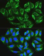 ATG16L1 Polyclonal Antibody
