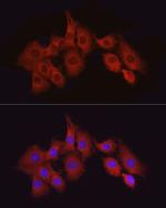 TAK1 Antibody in Immunocytochemistry (ICC/IF)