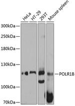 POLR1B Polyclonal Antibody