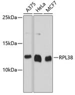 RPL38 Polyclonal Antibody