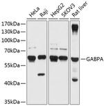 GABPA Polyclonal Antibody