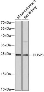 DUSP3 Polyclonal Antibody