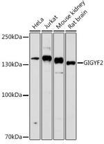 GIGYF2 Polyclonal Antibody