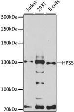 HPS5 Polyclonal Antibody