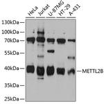 METTL2B Polyclonal Antibody