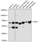 PKLR Polyclonal Antibody