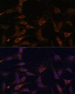RAB21 Antibody in Immunocytochemistry (ICC/IF)