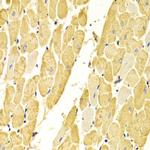 Carbonic Anhydrase III Antibody in Immunohistochemistry (Paraffin) (IHC (P))