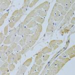Carbonic Anhydrase III Polyclonal Antibody