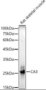 Carbonic Anhydrase III Antibody in Western Blot (WB)