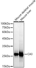 Carbonic Anhydrase III Antibody in Western Blot (WB)