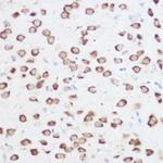 RPS24 Polyclonal Antibody