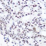 SART3 Polyclonal Antibody