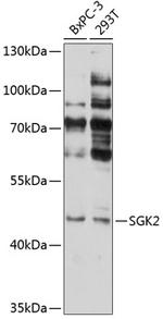SGK2 Polyclonal Antibody
