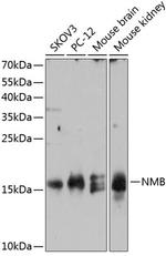 NMB Polyclonal Antibody