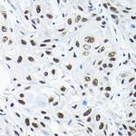 SNRPA1 Polyclonal Antibody