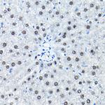SNRPA1 Antibody in Immunohistochemistry (Paraffin) (IHC (P))