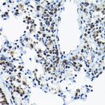SNRPA1 Antibody in Immunohistochemistry (Paraffin) (IHC (P))
