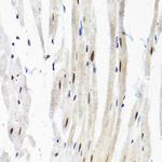 SNRPF Antibody in Immunohistochemistry (Paraffin) (IHC (P))