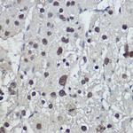 TSPYL1 Antibody in Immunohistochemistry (Paraffin) (IHC (P))