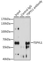 TSPYL1 Antibody in Immunoprecipitation (IP)
