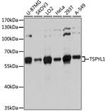TSPYL1 Antibody in Western Blot (WB)