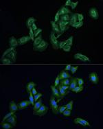 AGTRAP Polyclonal Antibody