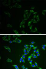 Adenylate Kinase 1 Polyclonal Antibody
