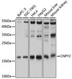 CNPY2 Antibody in Western Blot (WB)