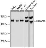 HOXC10 Polyclonal Antibody