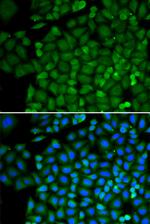 SELENBP1 Polyclonal Antibody
