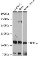 RRBP1 Antibody in Western Blot (WB)