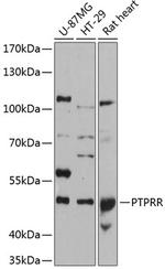 PCPTP1 Polyclonal Antibody