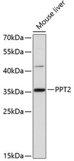 PPT2 Polyclonal Antibody