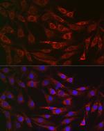 ALDH2 Antibody in Immunocytochemistry (ICC/IF)