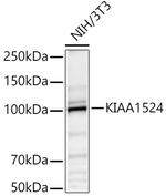 CIP2A Polyclonal Antibody