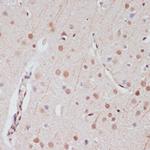 CREB Antibody in Immunohistochemistry (IHC)