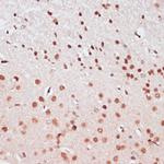 CREB Antibody in Immunohistochemistry (IHC)
