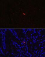 NTS Polyclonal Antibody